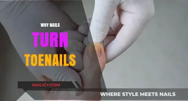 Why Toenails Differ: Unraveling the Mystery of Nail Transformation