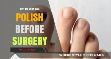 Why Dark Nail Polish is Banned Before Surgery: Explained