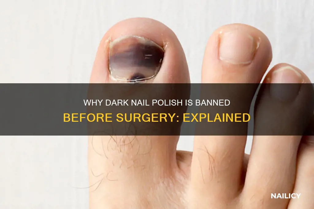 why no dark nail polish before surgery