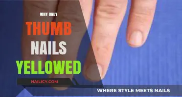 Why Thumbnails Yellow: Uncovering the Surprising Causes and Solutions