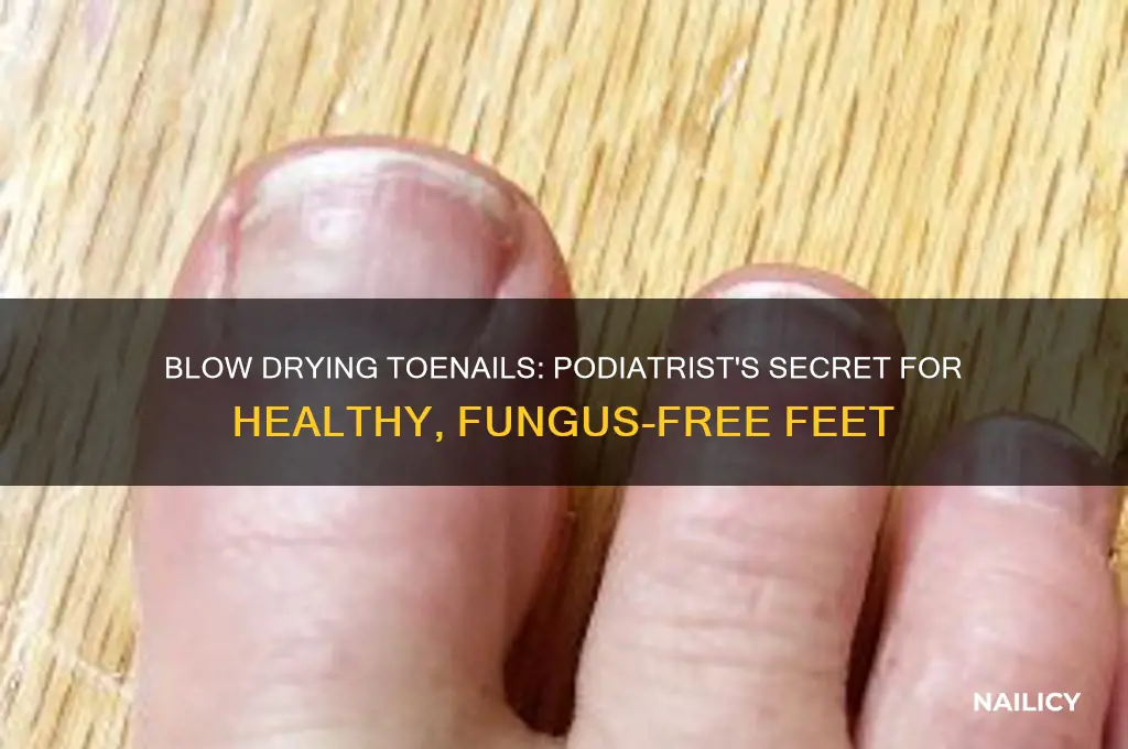 why podiatrist wants me to blow dry nail