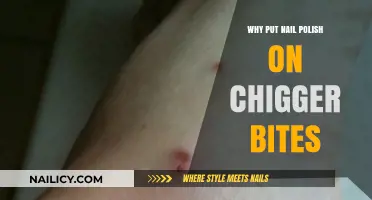 Nail Polish on Chigger Bites: A Surprising Itch Relief Hack