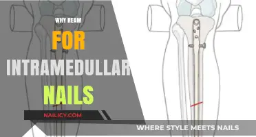 Why Ream for Intramedullary Nails: Enhancing Stability and Healing