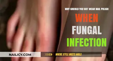 Avoid Nail Polish During Fungal Infections: Risks and Reasons