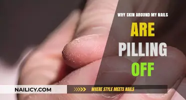 Why Is the Skin Around My Nails Peeling Off?