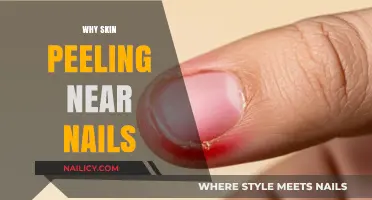 Why Skin Peels Near Nails: Causes, Remedies, and Prevention Tips