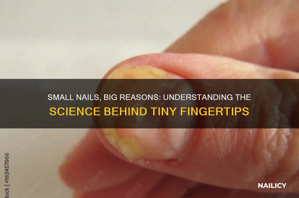 why small nails on fingers