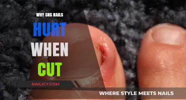 The Mystery of SNS Nails: Why the Pain?