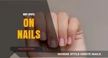 Understanding Nail Spots: Causes, Concerns, and When to Seek Help