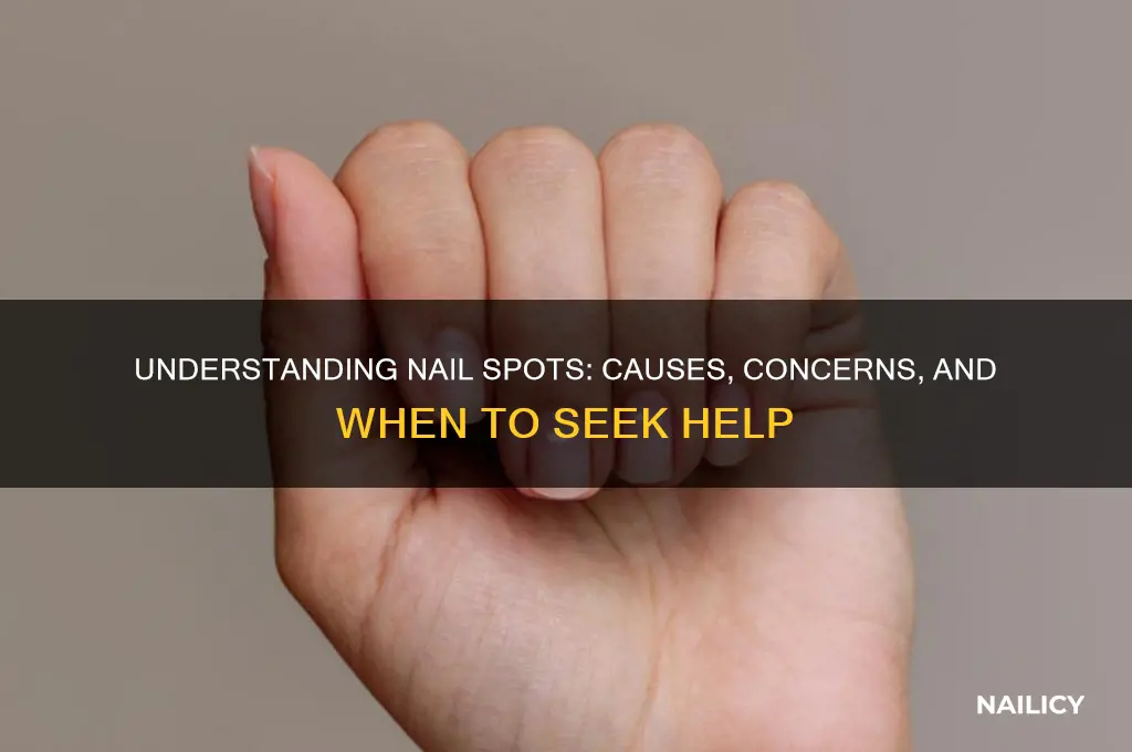 why spots on nails