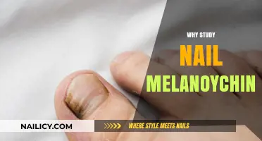 Understanding Nail Melanonychia: Importance, Diagnosis, and Treatment Insights