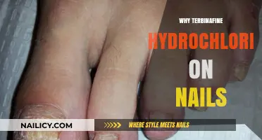 Terbinafine Hydrochloride for Nail Fungus: Benefits, Uses, and Effectiveness