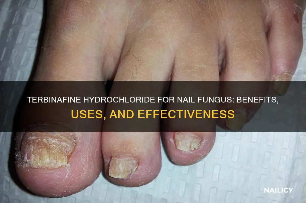 why terbinafine hydrochloride on nails