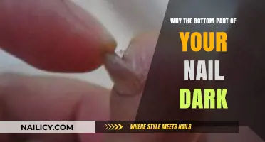 Why Do Toenails Turn Dark? Causes and Solutions Explained