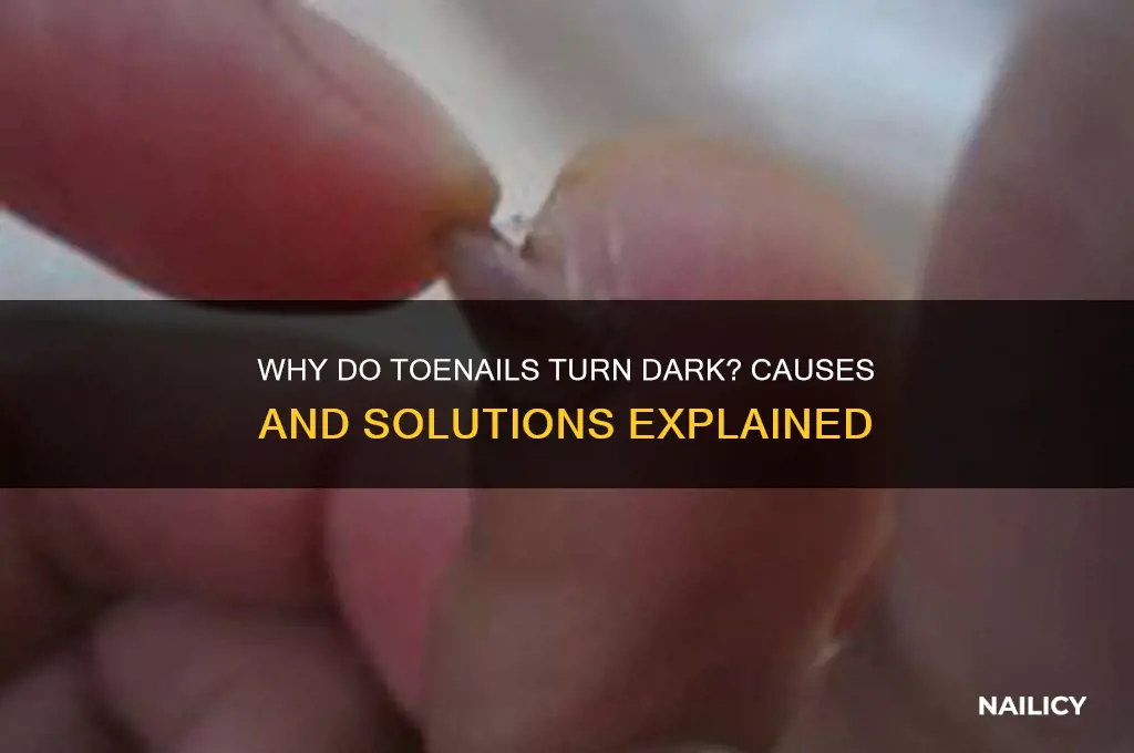 why the bottom part of your nail dark
