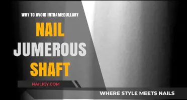 Avoiding Intramedullary Nail in Femur Shaft Fractures: Key Risks Explained