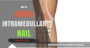 Risks of Intramedullary Nails: Why Alternative Treatments Are Safer
