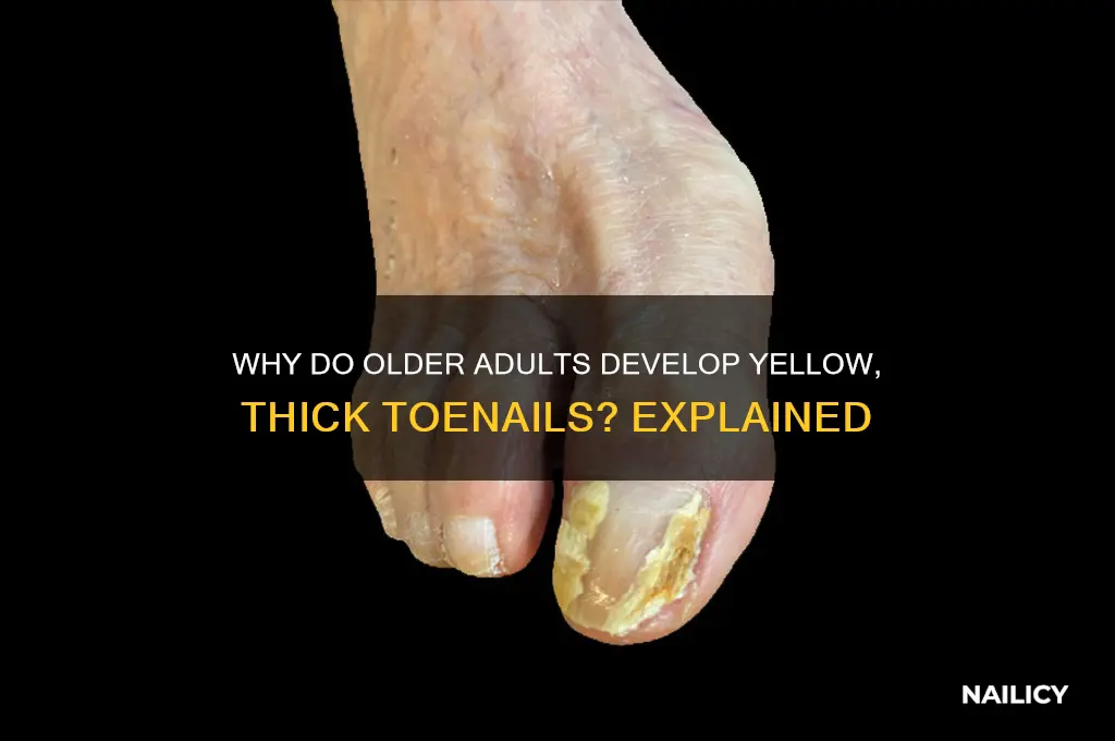 why to old people have yellow thick nails