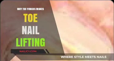 Toe Fungus and Nail Lifting: Understanding the Uncomfortable Connection