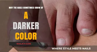 Toe Nails: Why Do They Turn Dark?