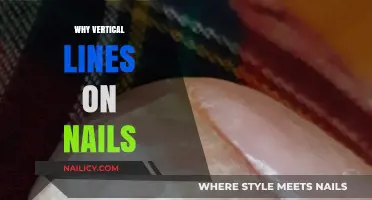Understanding Vertical Lines on Nails: Causes, Concerns, and Solutions