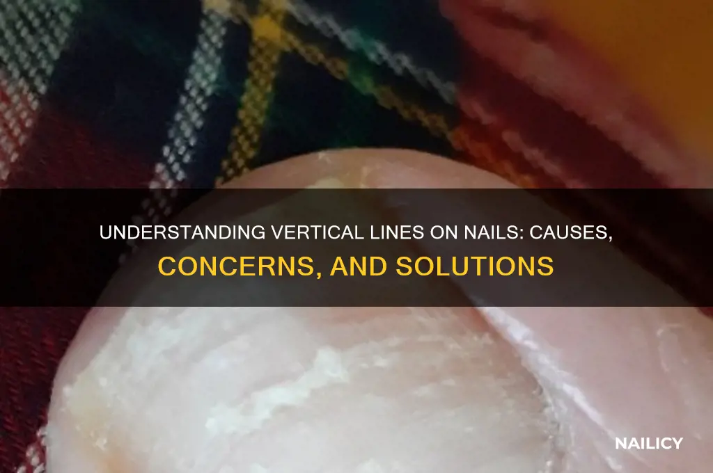 why vertical lines on nails