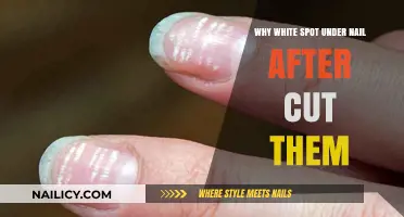White Spots Under Nails: What Do They Mean?