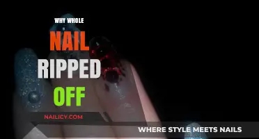 Why Your Whole Nail Ripped Off: Causes, Prevention, and Healing Tips