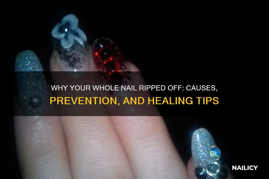 why whole nail ripped off