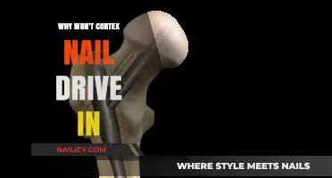 Troubleshooting Cortex Nail Insertion: Common Causes and Solutions