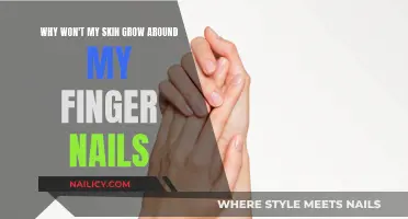 Skin and Nails: A Growth Mystery