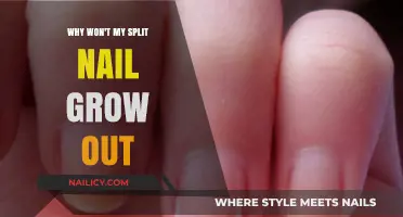 How to Fix a Stubborn Split Nail