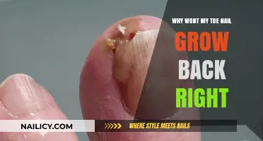The Mystery of Stubborn Toenail Growth