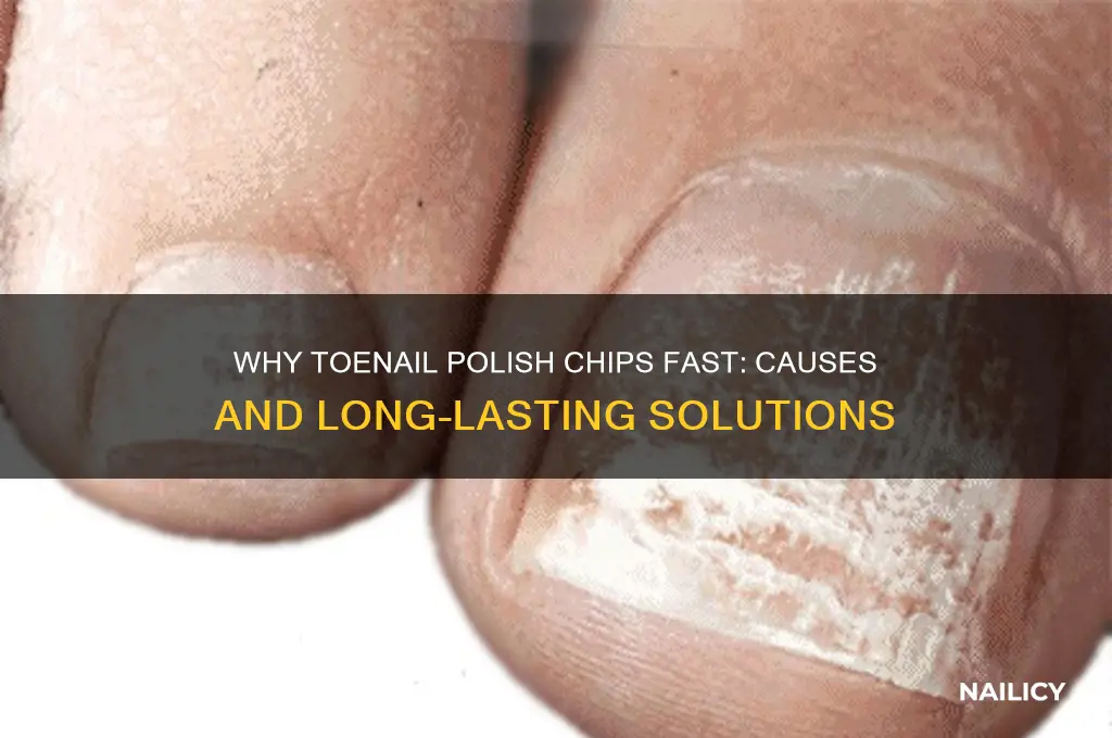 why wont nail polish stick long to toenails