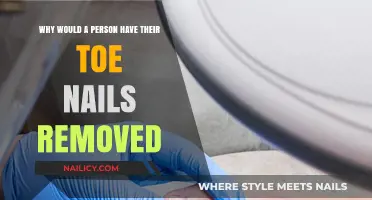 Toe Nail Removal: When and Why It's Necessary