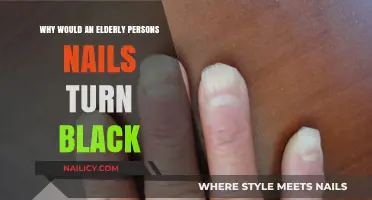 Why Elderly Nails Turn Black: Causes and Concerns Explained