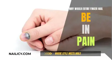 Mysterious Finger Pain: What Your Nails Say