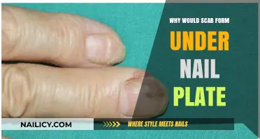 Understanding Scabs Under Nail Plates: Causes, Risks, and Treatment Options
