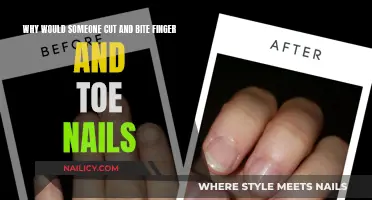Cutting and Biting Nails: Why This Strange Habit?