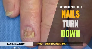 Unraveling the Mystery: Why Your Finger Nails Turn Down