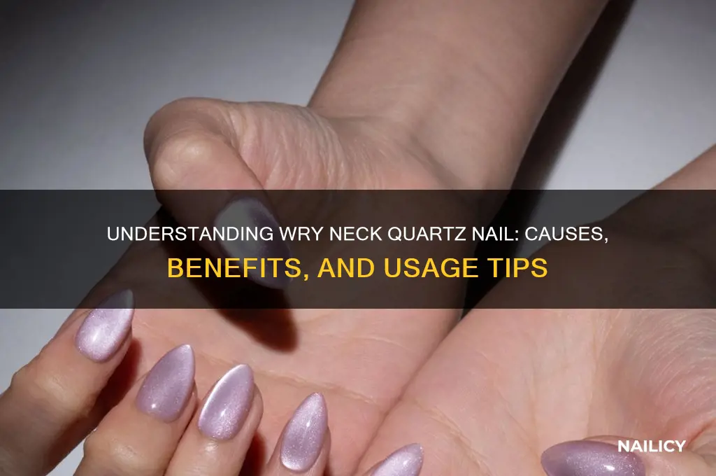 why wry neck quartz nail