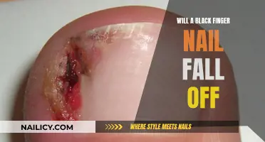 Black Fingernail Concerns: Will It Fall Off?