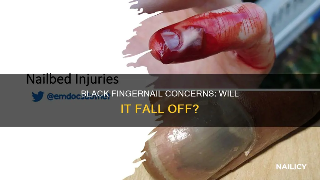 will a black finger nail fall off