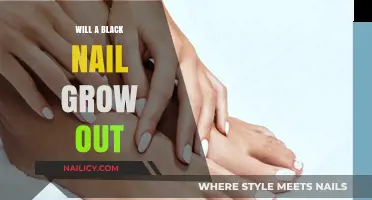Black Nail Mystery: What to Know About Nail Growth