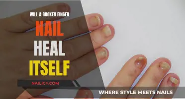 Healing a Broken Nail: Nature's Process or Medical Intervention?