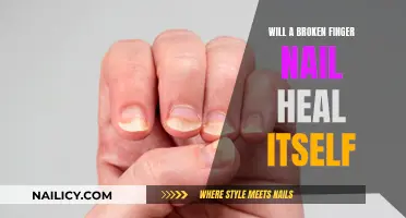 Healing a Broken Fingernail: What to Expect
