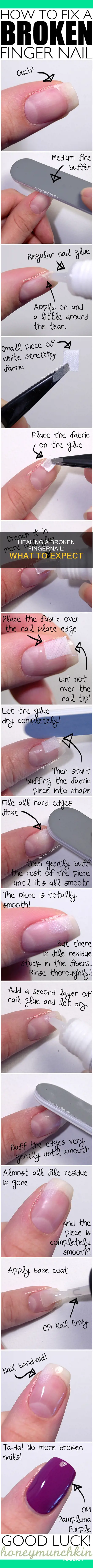 will a broken finger nail heal itself