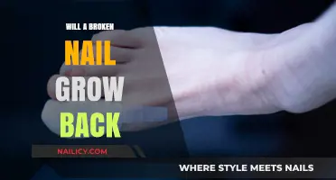 How to Heal a Broken Nail and Promote Regrowth