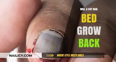 Healing a Cut Nail Bed: What to Expect