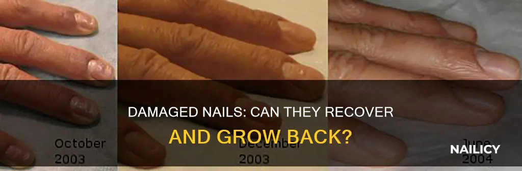 will a damaged nail grow back